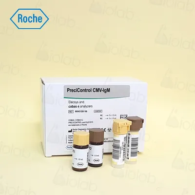 COVID-19 IgG/IgM Rapid Test Kit (Colloidal Gold) - JOYSBIO Biotechnology