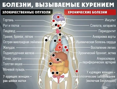 Курение и беременность: кратко об основных заблуждениях - ГБУЗ МО  «Серпуховский родильный дом»