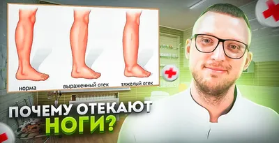 Липосакция ног и ягодиц в VIP Clinic. Цены указаны в прайс-листе