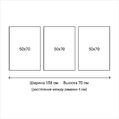 Мышцы ноги. Вид сзади средний слой плакат глянцевый А1+/А2+ › Купить оптом  и в розницу › Цена от завода