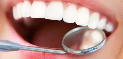 Здоровые зубы: 5 золотых правил- Ирригаторы DEMIAND