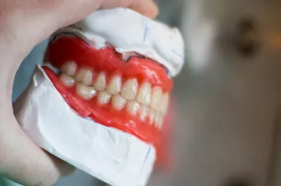 Здоровые зубы: основные правила ухода. | Просто о здоровом образе жизни |  Дзен