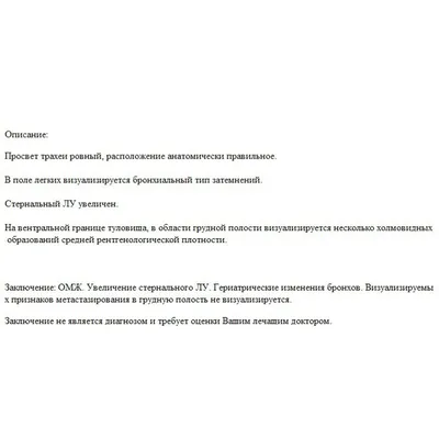 Рак ротоглотки. #карцинома ротоглотки | Врач-онколог Чачух Азамат Заурович  | Дзен