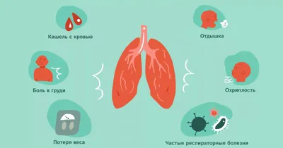 Аллергический кашель симптомы и лечение, кашель при аллергии — Fenkarol®