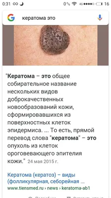 Удаление кератомы лазером в Venus Clinic, Киев