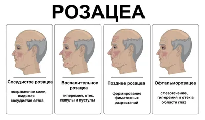 Хеликобактер пилори - симптомы, диагностика и лечение инфекции