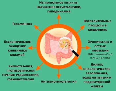 Симптомы хеликобактера и способы его лечения — блог медицинского центра ОН  Клиник