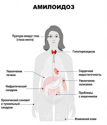 Выпадение волос и болезни желудочно-кишечного тракта | Клиника АЛОДЕРМ ,  Москва