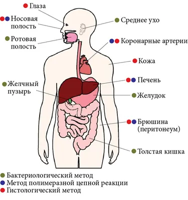 Хеликобактер пилори: что это, сиптомы и как лечить