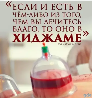 Что такое хиджама, кому ее полезно делать, в чем цель и смысл процедуры? |  Stoletnik.Ru | Дзен