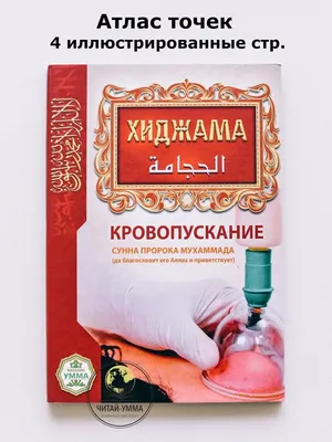 Хиджама, кровопускание - цена в Казани, сделать кровопускание банками в  клинике Наран