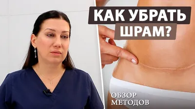 Лазерное удаление шрамов на лице в Киеве, шлифовка Coolaser Clinic