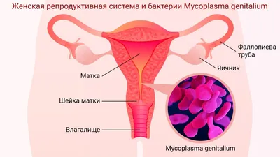 Лечение молочницы: схемы, лекарства, советы по эффективному лечению