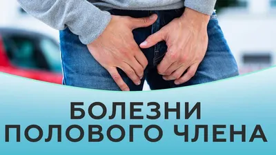 Хламидиоз лечение консультация в экспертной клинике ID-CLINIC  Санкт-Петербург