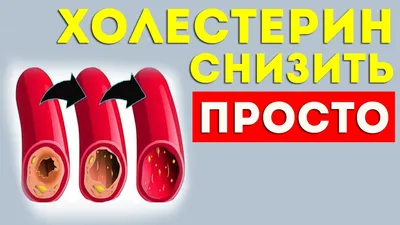 Врач-кардиолог Мария Кириллова назвала признаки повышенного уровня  холестерина на лице - CT News