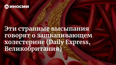 Подростковые прыщи ✔️ Причины, симптомы, лечение акне | \"Где мои дети\" Блог