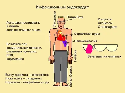 Сосудистая патология: причины появления и способы устранения |  Косметологические аппараты