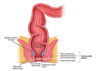 Рак анального канала: признаки, симптомы, лечение, прогнозы