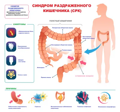 Рак кишечника