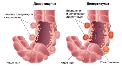 Кишечный инстинкт» - система навигации предков человека