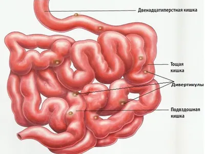 АКТУАЛЬНЫЕ ВОПРОСЫ ДИАГНОСТИКИ И ЛЕЧЕНИЯ РАКА ТОЛСТОЙ КИШКИ