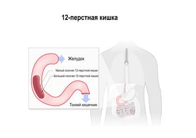 Рак прямой кишки, симптомы, лечение, профилактика у женщин и мужчин