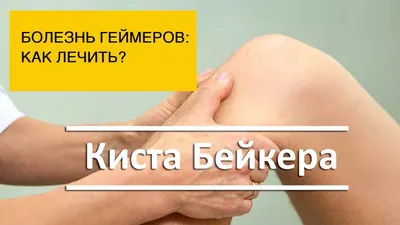 Резекция мениска в Москве, цены, консультация врача-травматолога| Клиника  «Ваш Доктор»