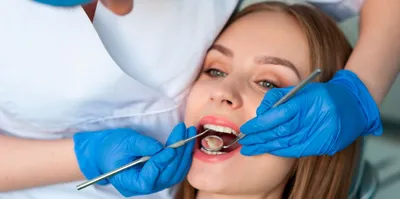 Киста после удаления зуба: кто виноват и как лечить заболевание | Dental Art