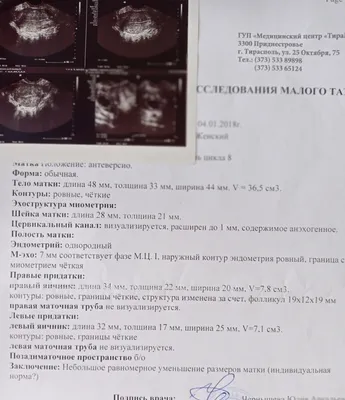 Параовариальная киста яичника – симптомы, причин, диагностика и лечение в  клинике «Будь Здоров»