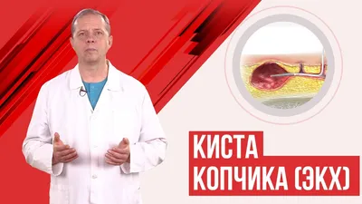 Киста копчика. Эпителиальный копчиковый ход. - YouTube