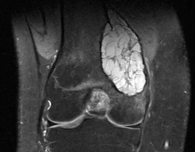 Фото и видеоматериалы по специальности Проктология - Surgitron