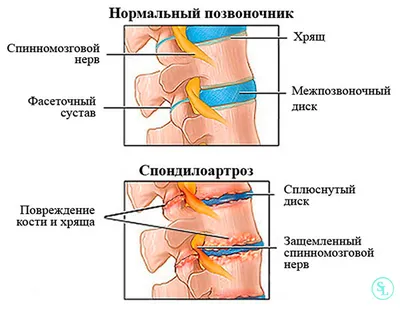 Удаление вросшего ногтя в Москве|Стоимость операции в клинике|удалить  вросший ноготь по низкой цене