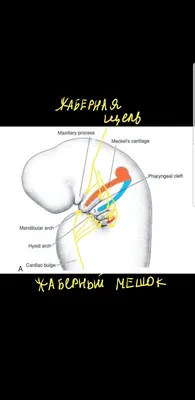 Ангина: ранние симптомы, признаки и способы лечения