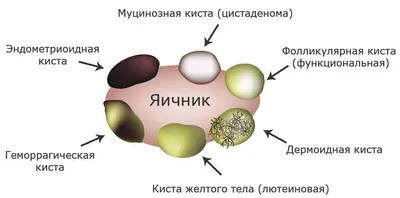 Гематометра – симптомы, причины, признаки, диагностика и лечение у женщин в  клинике «Будь Здоров»