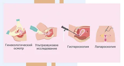 Лечение эрозии шейки матки - записаться в Москве | Диамед