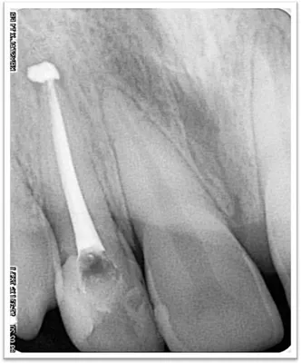 Алгоритм внутриротового лучевого исследования и описания снимков зубов -  DENTALMAGAZINE.RU