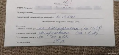 Кинолог рассказал, чего нельзя делать при обнаружении клеща на собаке - РИА  Новости, 30.04.2021