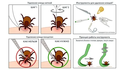 Укус клеща, как уберечься от клещей, симптомы после укуса