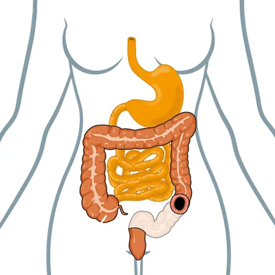 Стома дала мне свободу\". Как жить, если удален кишечник - BBC News Русская  служба