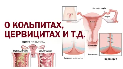 Феминтим гель Арго (заживление слизистой, зуд, сухость, инфекция, кольпит,  цистит, вагинит, молочница, эрозия) (ID#1376674350), цена: 364 ₴, купить на  Prom.ua