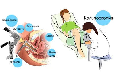Кольпоскопия шейки матки, цена - Клиника «Геном» в Томске