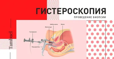 Кольпоскопия шейки матки - цена, сделать в СПб по записи