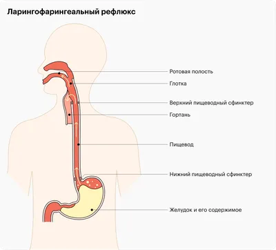 Практическое обучающее занятие \"Ком в горле. Как избавиться\".  Самопознание.ру