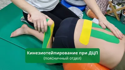 Некоторые подходы к формированию изобразительной деятельности старших  дошкольников с двигательными нарушениями