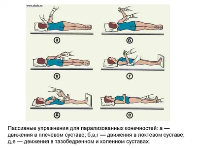 MedWeb - Хронический гастрит: лечебная гимнастика