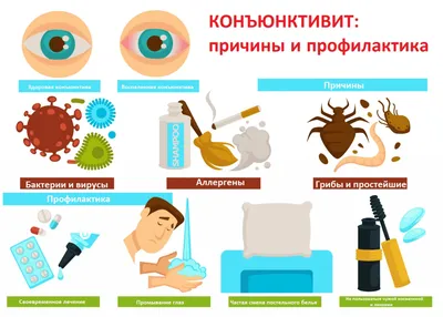 Филиал «КазНИИ глазных болезней» в г. Шымкент - ⠀ ✓Жазғы маусымның басталуы  көптеген адамдар үшін аллергияның басталуын білдіреді.⠀ Аллергияның  жағымсыз белгілерінің бірі-аллергиялық конъюнктивиттің дамуы ⠀ ⠀ 📍Бүгін  біз сізге осы ауру туралы