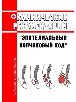 МРТ копчика и крестцово-копчикового отдела по цене от 3200 рублей в Москве