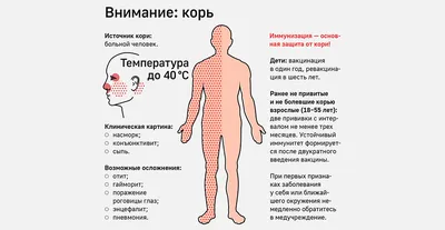 Роспотребнадзор перечислил симптомы кори - РИА Новости, 23.04.2023