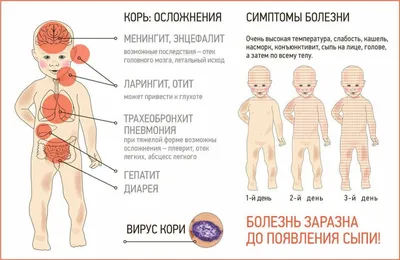 Опубликованы фотографии заболевших корью пензенских детей — Медицина —  Пенза СМИ