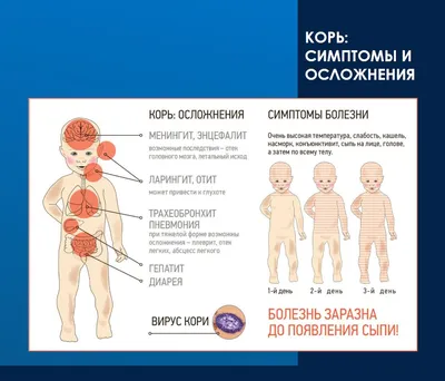 Корь у взрослых и детей: симптомы, профилактика и прививки